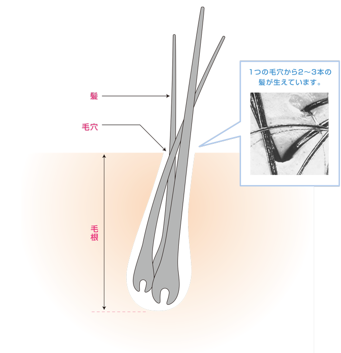 e0184077_23010593.png