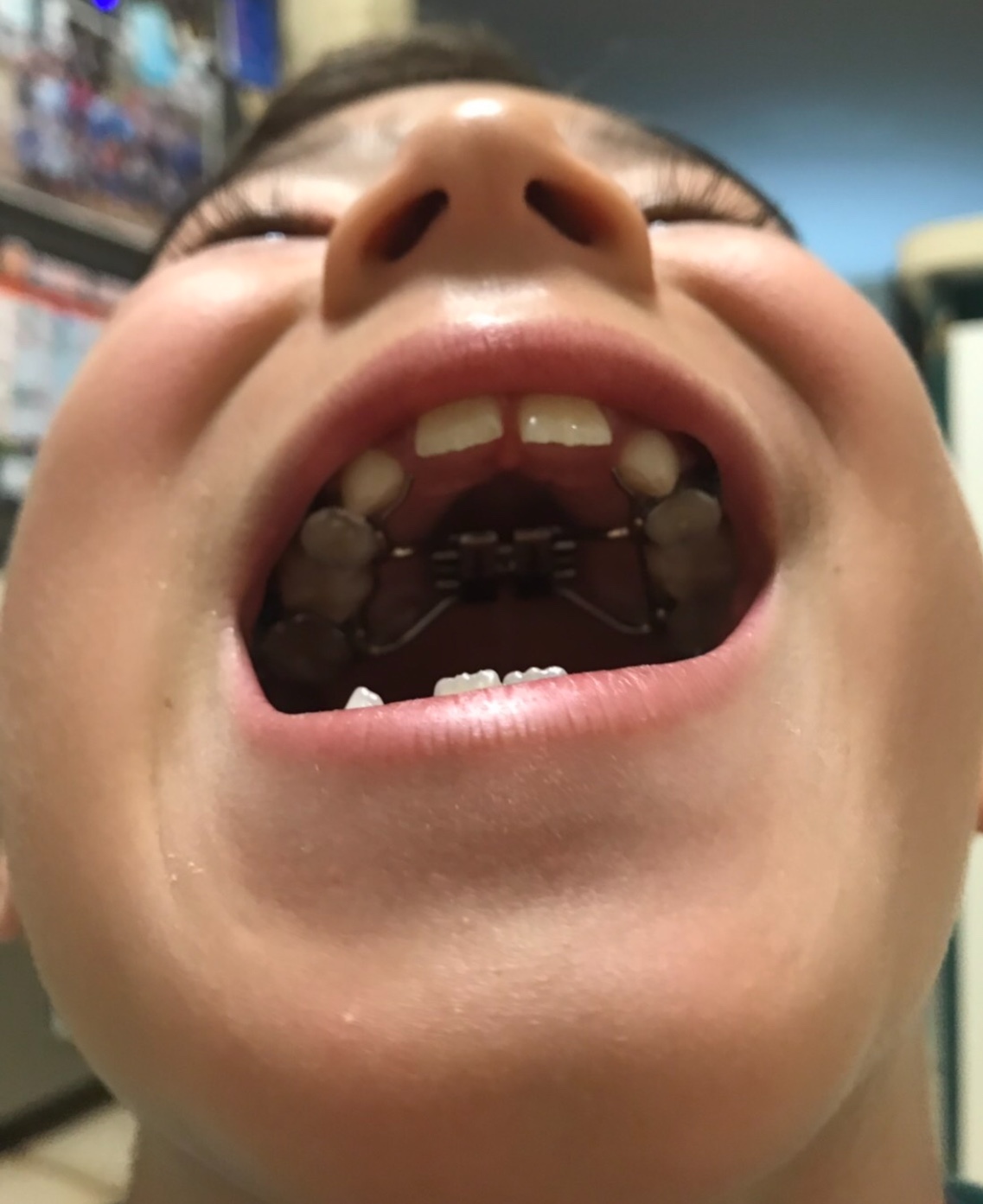 a0053063_17180682.jpeg