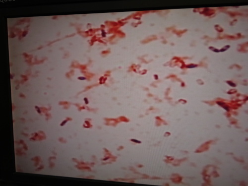 納豆菌のグラム染色 ねぎし泌尿器科 内科ブログ