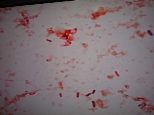 納豆菌のグラム染色 ねぎし泌尿器科 内科ブログ