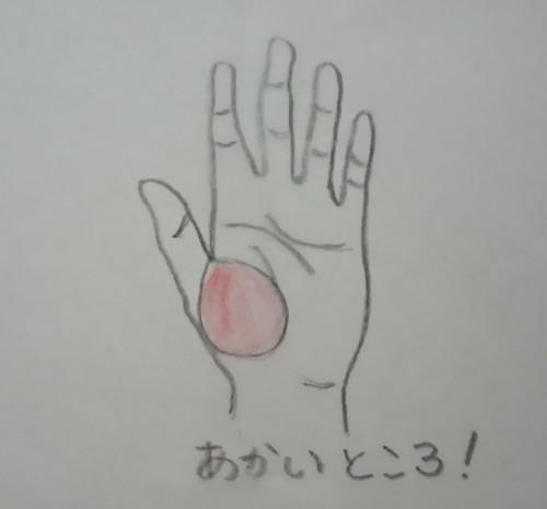 痛み 付け根 親指 の の 母指CM関節症｜ナオール