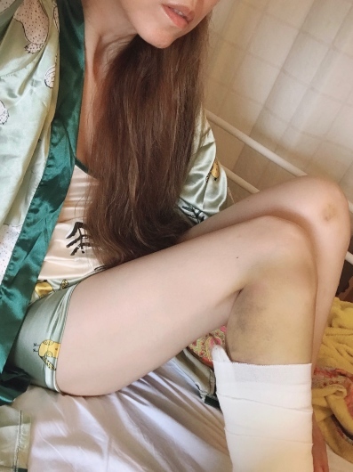 明日手術。_a0050302_07391007.jpeg