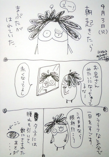 瞼が腫れた へなまめ星人の手帖 瞼が腫れた へなまめ星人の手帖