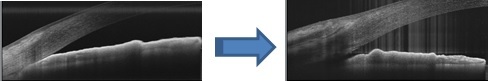 第19回 近畿眼科オープンフォーラム その2(1160)_f0088231_11403439.jpg