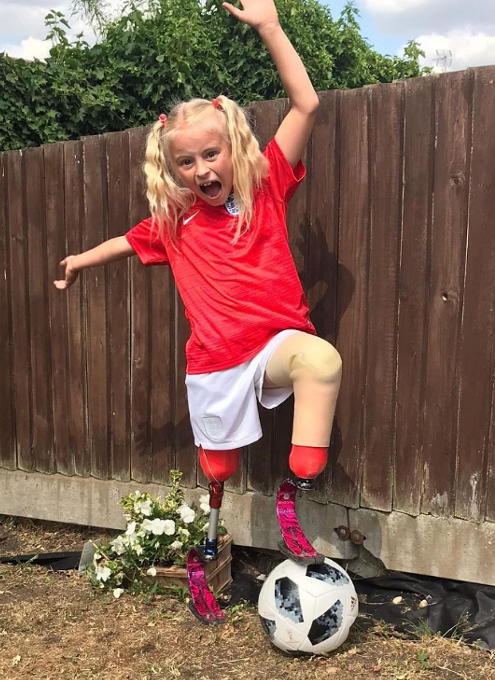 NYFWの奇跡、両足義足の９歳の少女デイジーちゃんがファッション・モデル⁉_b0007805_23331154.jpg