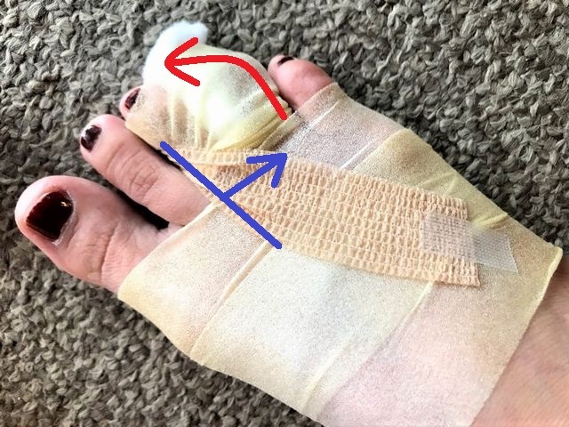 足指骨折の検索をしてたどり着いた皆様へ 十目一ハ研究所 ミルニング部 足指骨折の検索をしてたどり着いた皆様へ 十目一ハ研究所 ミルニング部
