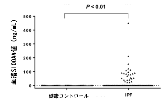 IPFにおける血清S100A4値は疾患進行のバイオマーカーとして有用_e0156318_9354057.png