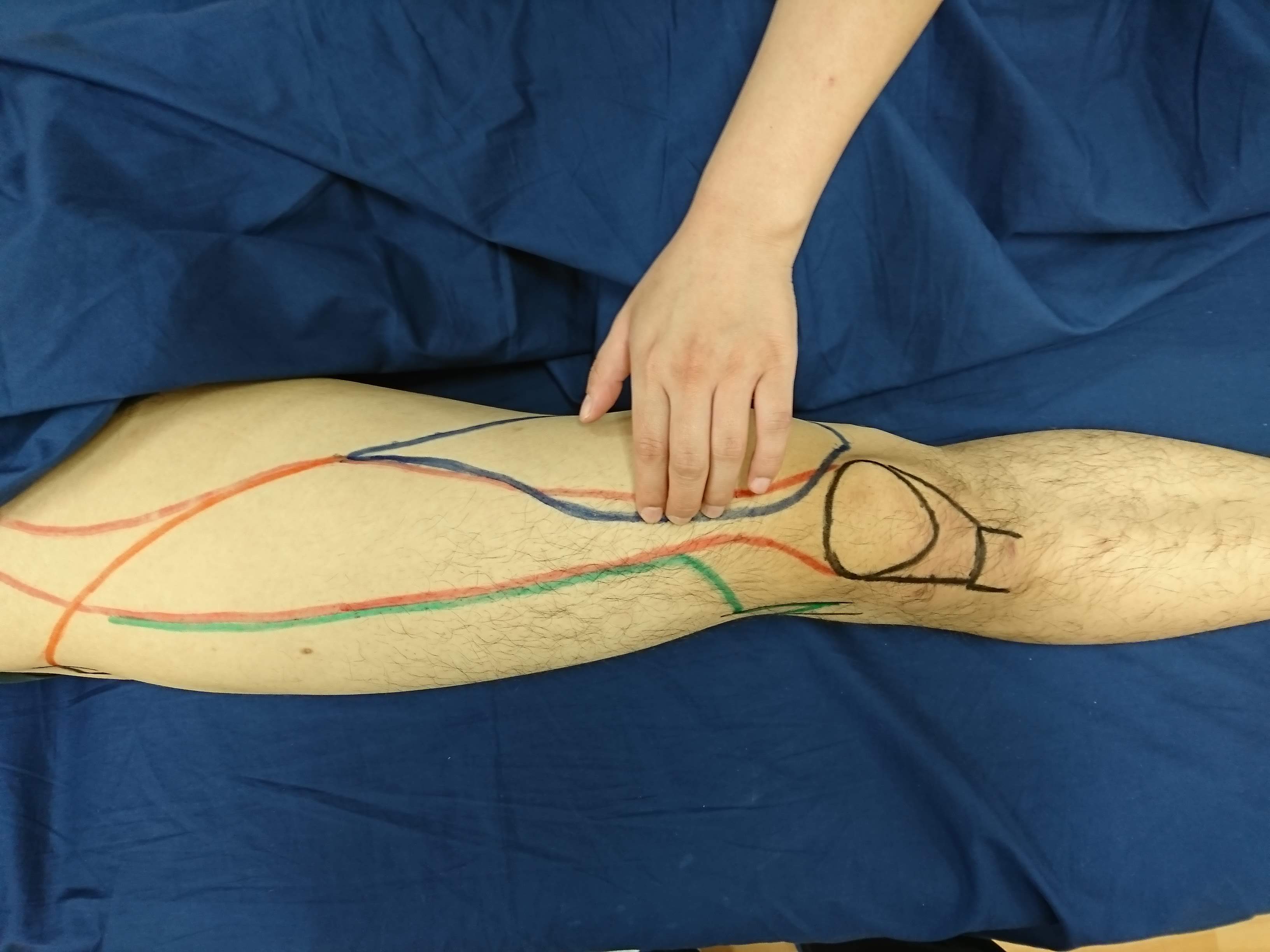 第171回TOC体表解剖勉強会｜大腿四頭筋(大腿直筋、内側広筋、中間広筋、外側広筋)の触察技術の向上_b0329026_00121845.jpg