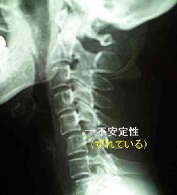 首が原因で・・・ギックリ腰?_e0097212_11362990.jpg