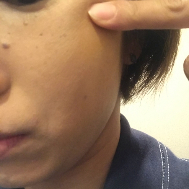 40歳目前 毛穴の開き_b0366709_10052810.jpg