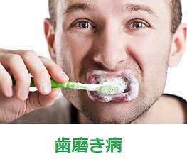虫歯・歯周病の原因は何でしょうか_d0338857_07063186.jpg