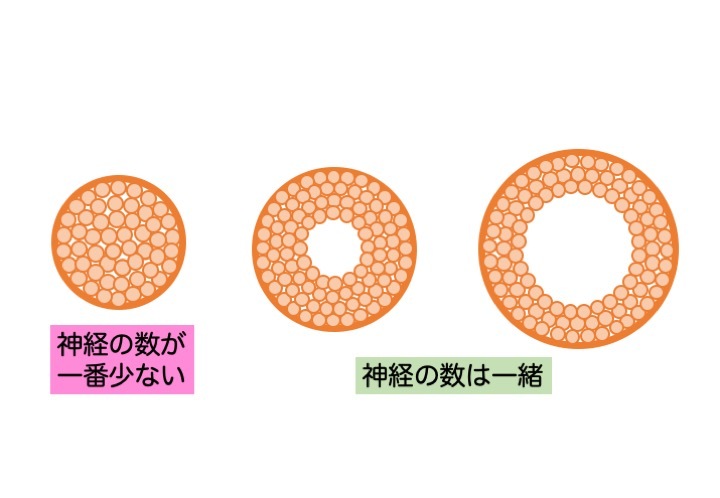 緑内障の誤解 その3「眼圧が高いと緑内障」 part 2_a0257968_16483182.jpeg