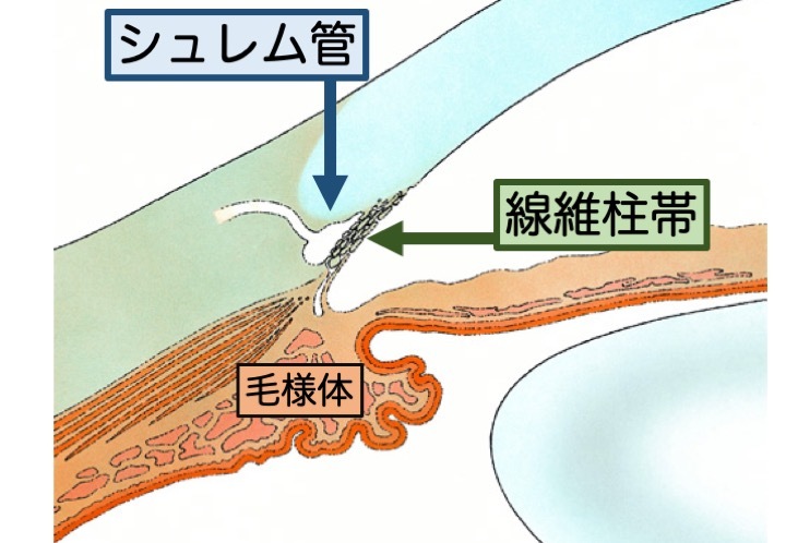 緑内障の誤解 その4「手術で治療できる」 part 6_a0257968_16383353.jpeg