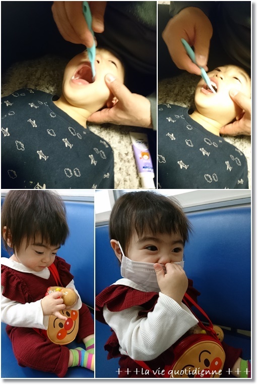 【鏡開きレシピ】お餅のアレンジ料理と王子の大変だった耳掃除!_a0348473_06180039.jpg