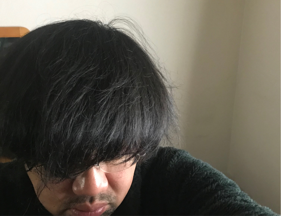 シゲさんの頭髪問題_b0199097_18203171.jpg