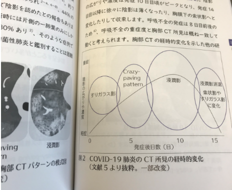 本の紹介:呼吸器内科医が解説! 新型コロナウイルス感染症 — COVID-19 —_e0156318_16435532.png