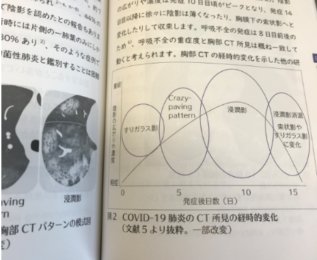 本の紹介：呼吸器内科医が解説! 新型コロナウイルス感染症 — COVID-19 —_e0156318_16435532.png