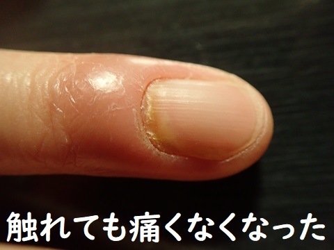 肛門腺から匂ってきた!!_c0182012_15015663.jpg