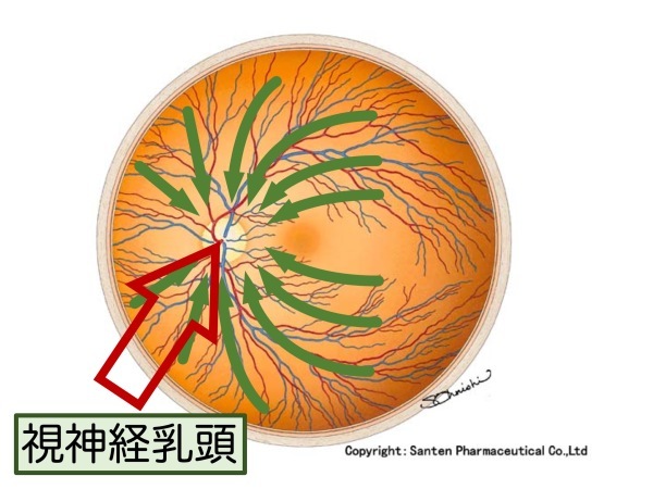 第4章 実践その1 緑内障の見つけ方_a0257968_15590791.jpeg