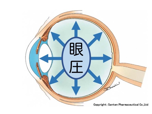 第3章 誤解その3「眼圧が高いと緑内障」_a0257968_16055567.jpeg