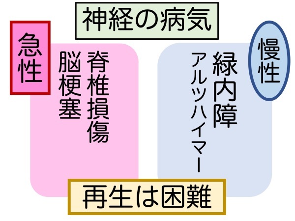 第2章 誤解その2「突然失明する」_a0257968_16110985.jpeg