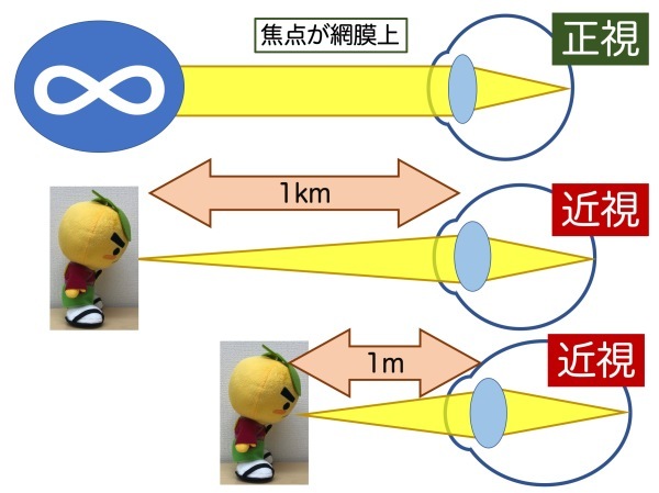 余談5の2 100km先が見えても近視_a0257968_12555696.jpeg