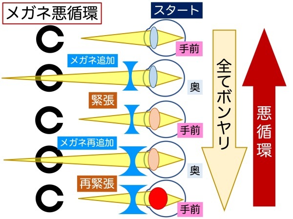 第4章 その3 ココロの問題で視力低下?_a0257968_13144753.jpeg