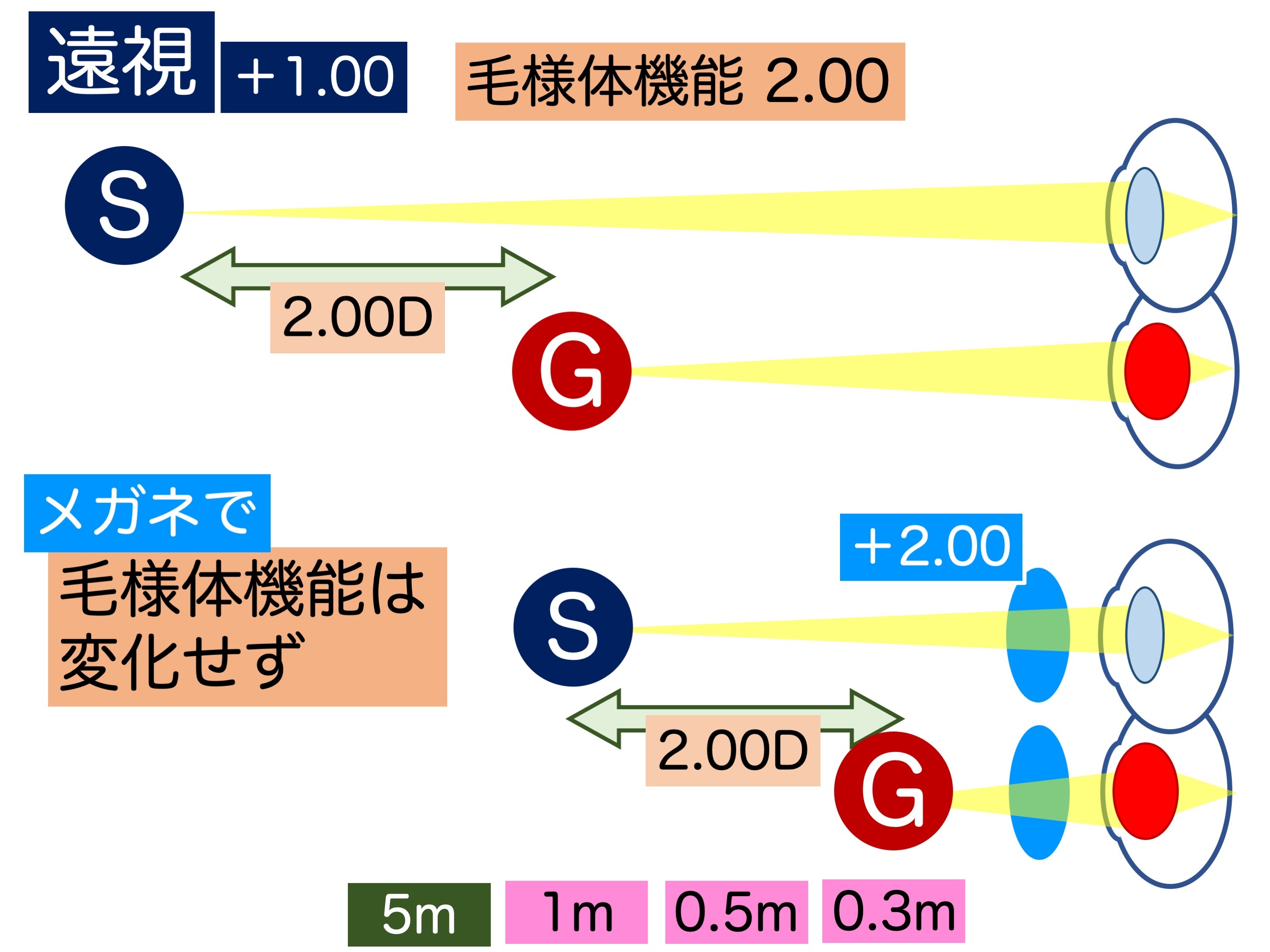 第3章 その4 近見障害とメガネ_a0257968_13322440.jpeg