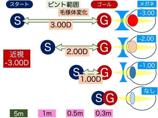 第3章 その4 近見障害とメガネ_a0257968_13331149.jpeg