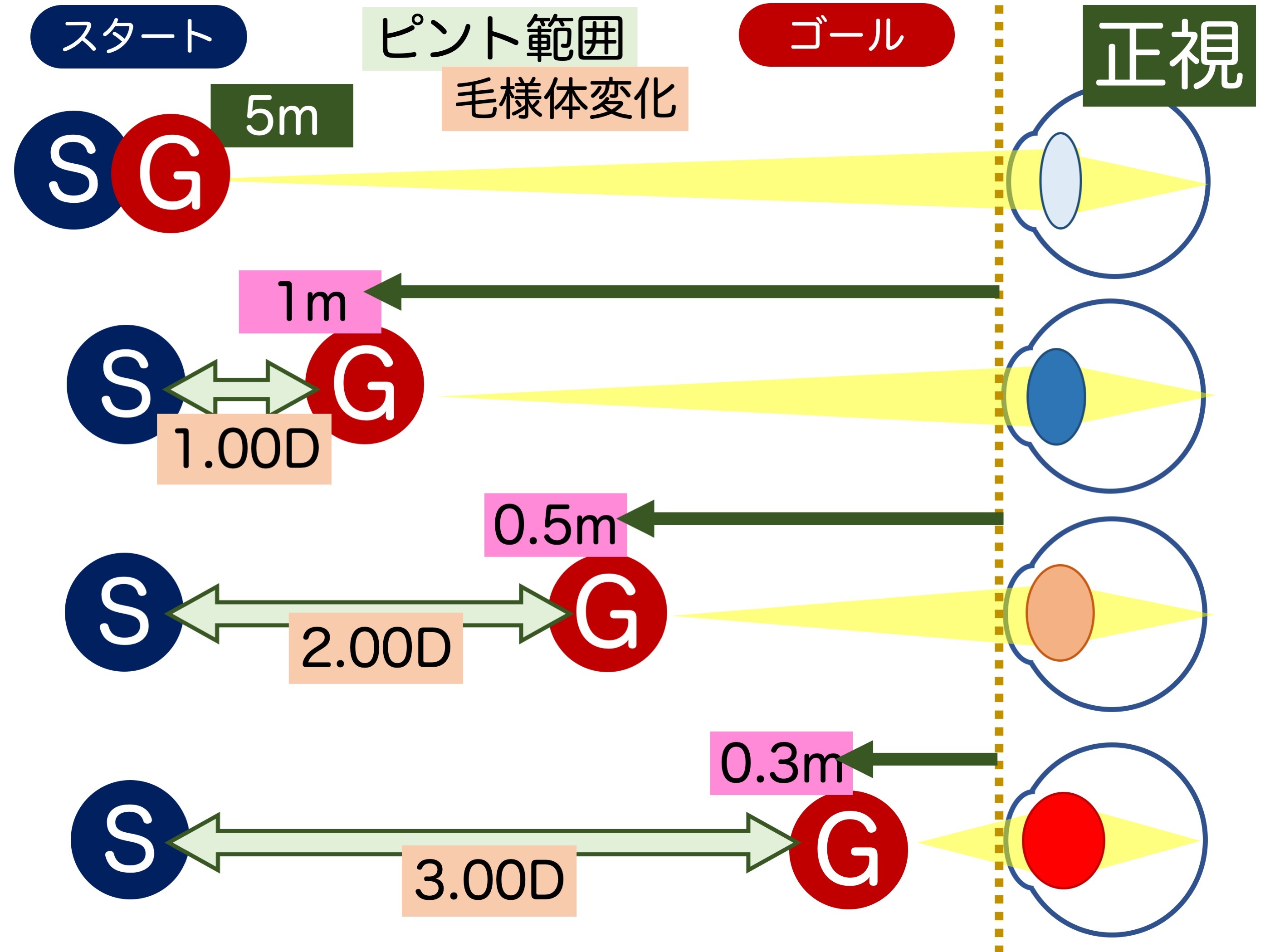 第3章 その3 近見障害_a0257968_13365363.jpeg