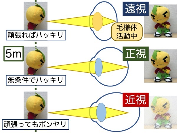 第2章 その1 遠視と近視のボーダーライン_a0257968_13575823.jpeg