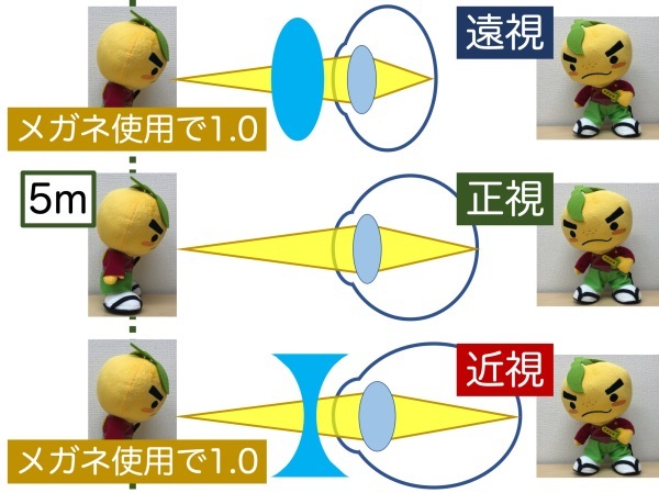 第2章 その1 遠視と近視のボーダーライン_a0257968_13581256.jpeg