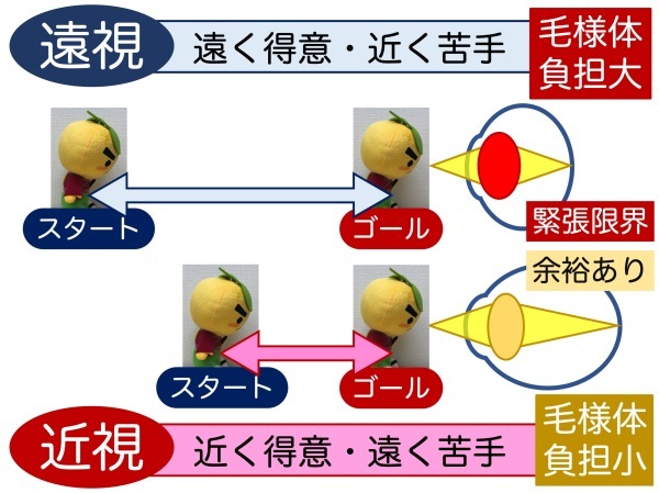 余談1 そんなに近視が悪いのか_a0257968_14000783.jpeg