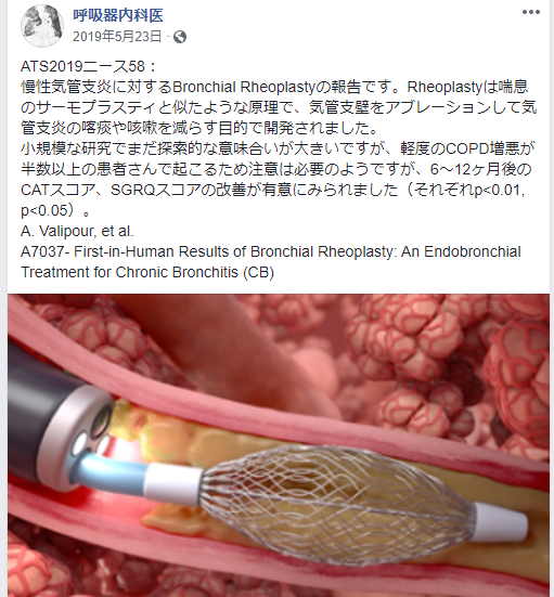 慢性気管支炎に対するBronchial Rheoplasty_e0156318_22301265.png