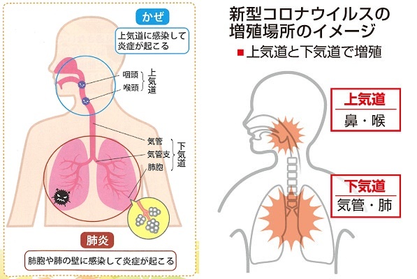 夏風邪は 馬鹿がひく ゆさをぢさんの されがまね話