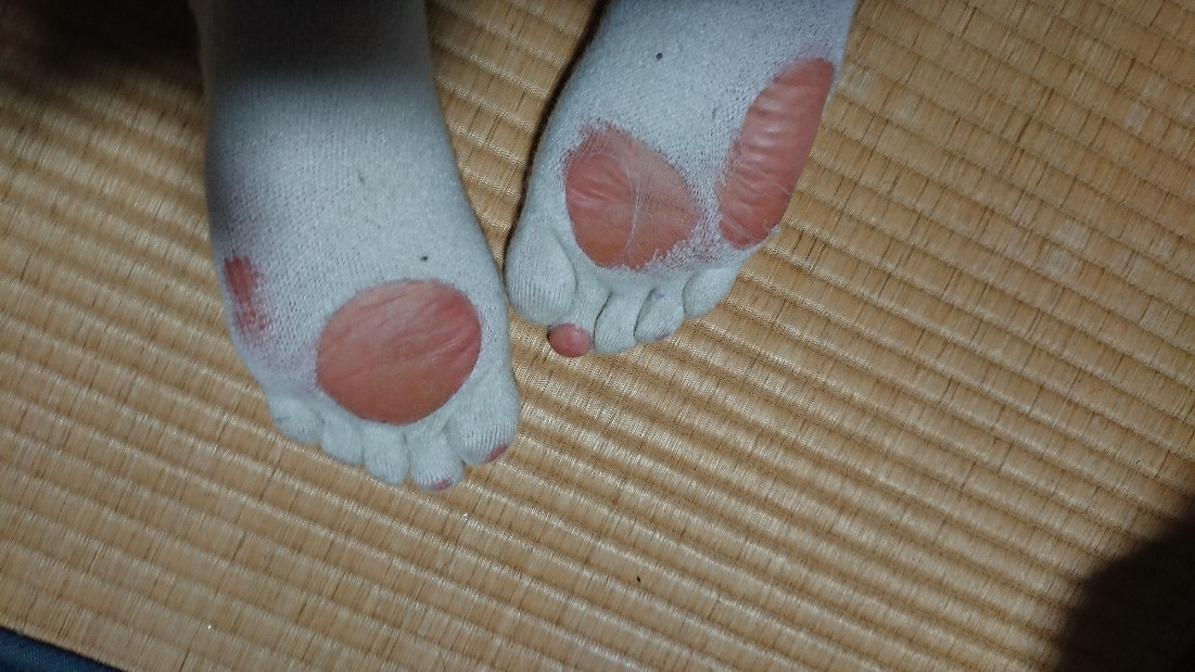 靴下に穴が開くんです 佐賀 嬉野温泉きららカフェ