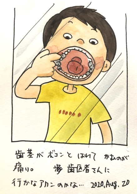 歯茎 痛い_f0072976_12551453.jpeg