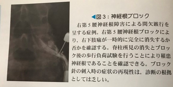 神経根ブロックはあみだくじ_b0052170_02225039.jpg
