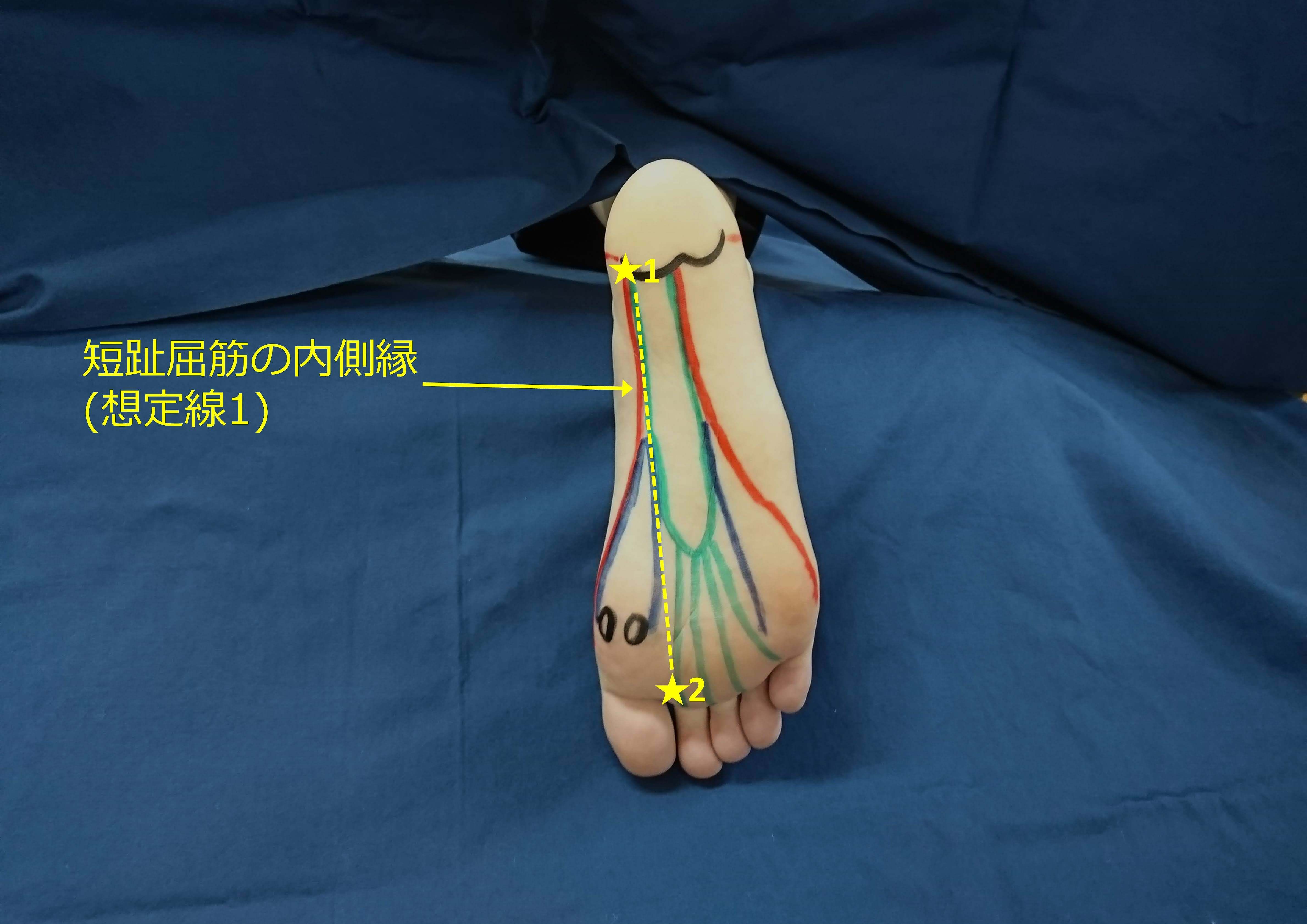 写真で学ぼう！短趾屈筋を触察するためのランドマーク_b0329026_20134551.jpg