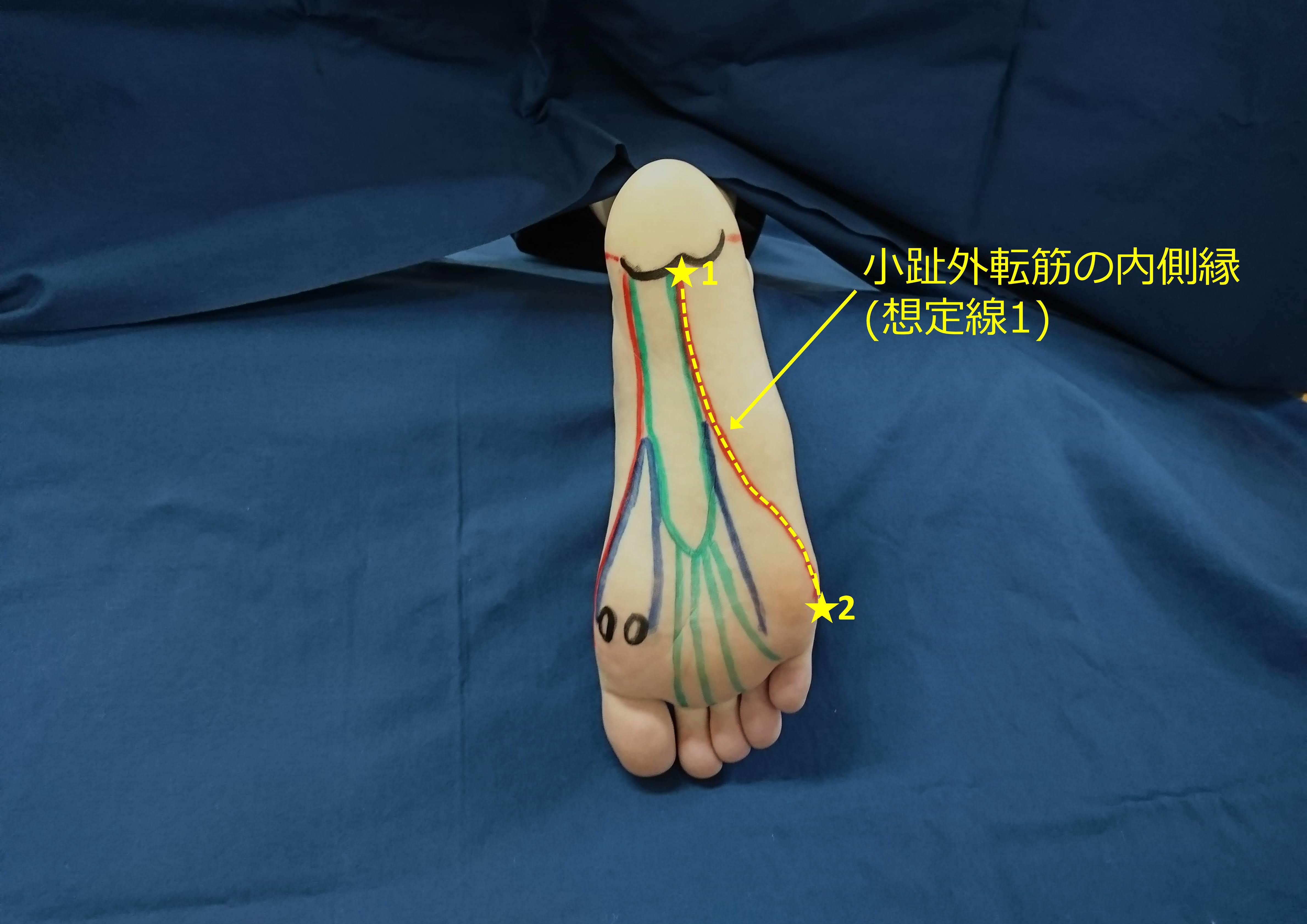 小趾外転筋 短小趾屈筋 小趾対立筋を触察するためのランドマーク たてやま整形外科クリニック リハスタッフブログ