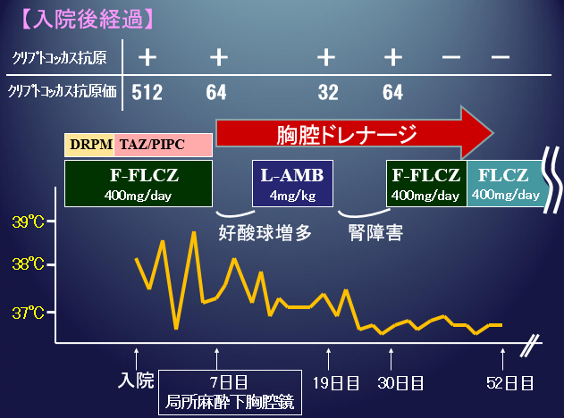 本の紹介:レジデントのためのスライドのポイント_e0156318_14212515.png