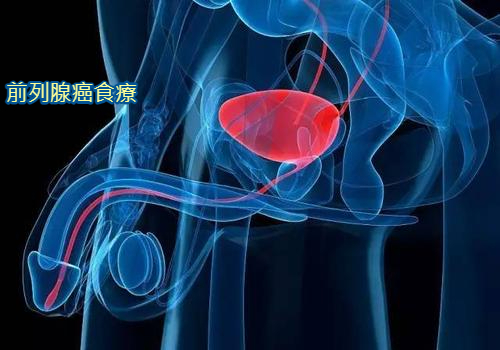 良性前立腺肥大は前立腺癌を引き起こすのでしょうか?_c0366805_18071450.jpg