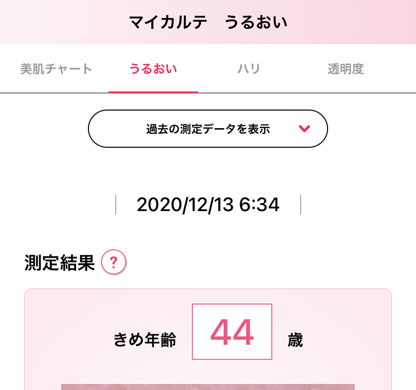 肌年齢測定アプリ【肌パシャ（資生堂）】_d0327373_17243834.jpeg