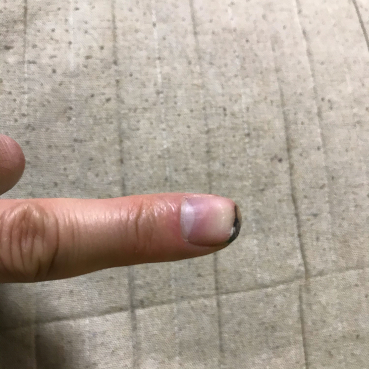 実録 爪は何日で生え変わる 本日も晴天なり ちょっとそこまで自転車で 実録 爪は何日で生え変わる 本日も晴天なり ちょっとそこまで自転車で