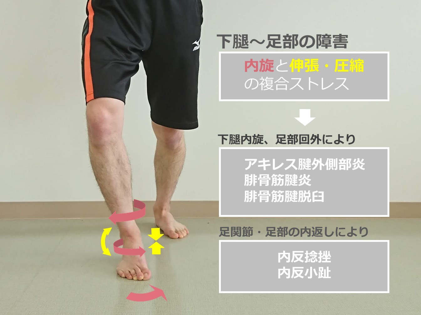 KOTIにより生じる下腿から足部へのメカニカルストレスとスポーツ外傷・障害_b0329026_17233370.jpg
