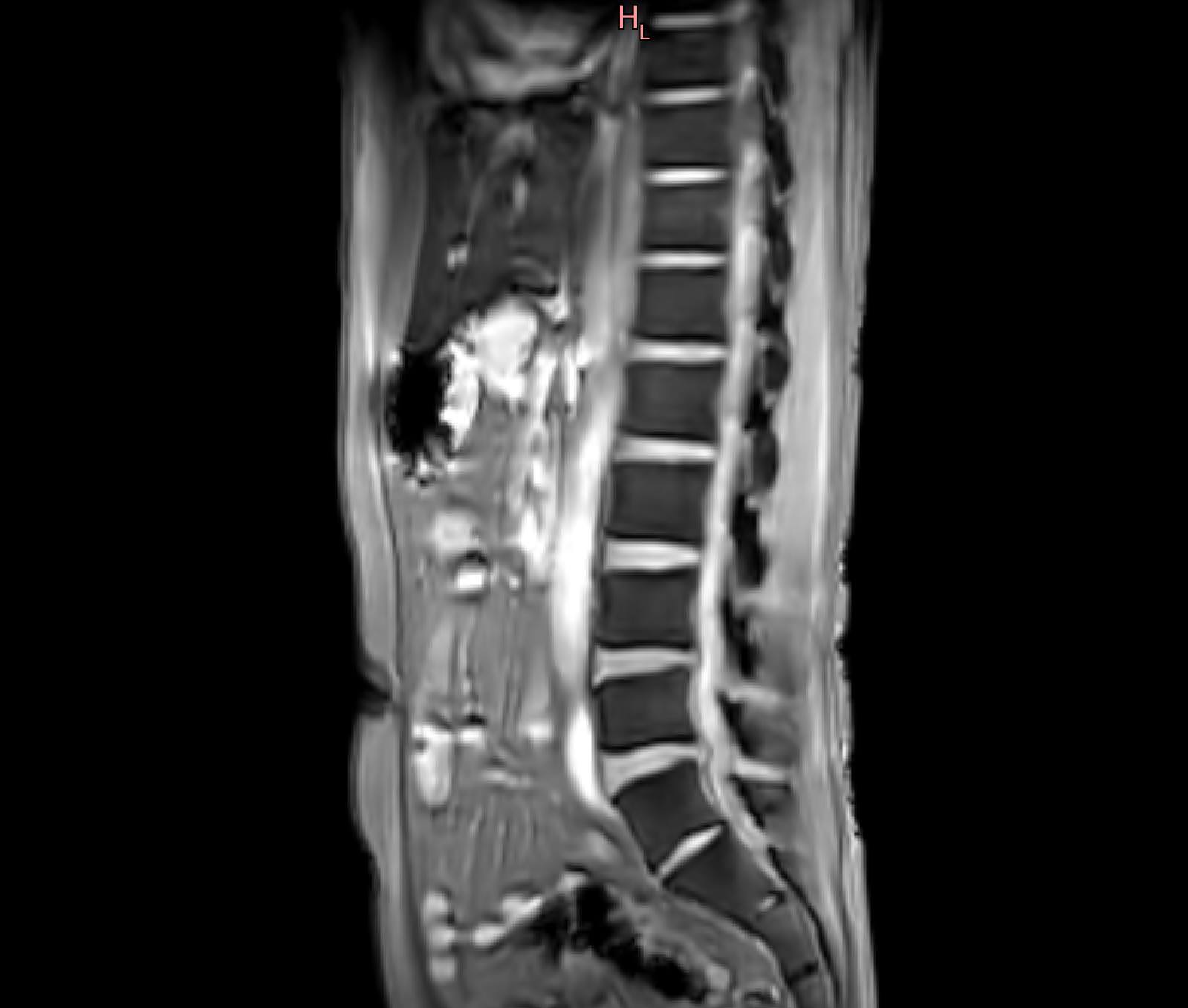 急性腰痛症_c0006305_08405347.jpg