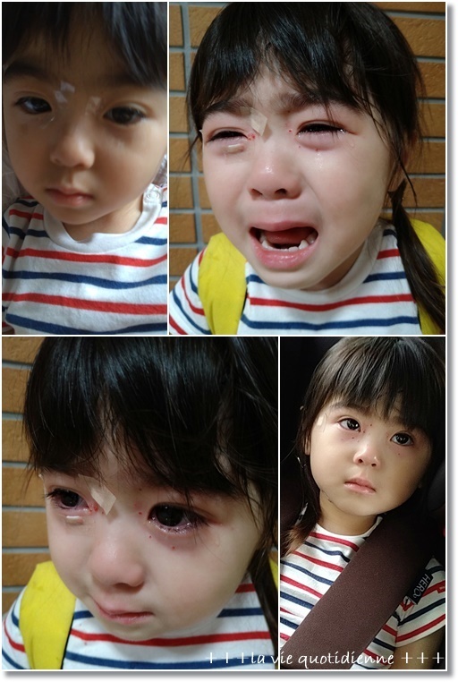 【水いぼ】2歳児姫★目のキワに出来た水イボとの闘い。。。御褒美パフェ_a0348473_06202239.jpg