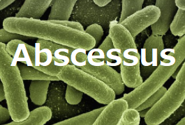 肺Mycobacterium abscessus症に対するクロファジミン_e0156318_08144262.png