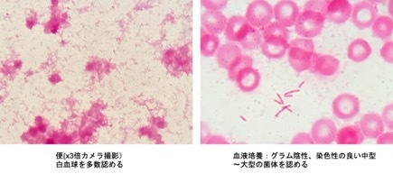 下痢からの菌血症症例_d0402367_12025827.jpg