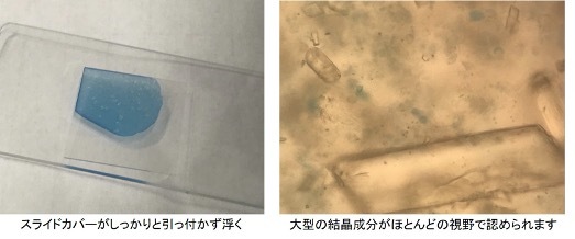 前医でセフカペンピボキシル®️が処方されているurosepsis, 尿に菌がいないがWBC多数、次に参考にする所見は?_d0402367_13101074.jpg
